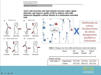 fisioterapia #traumatoortopedia #exercíciosterapêuticos #escoliose